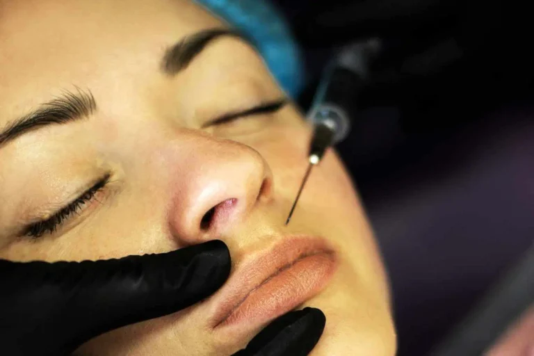 Lip-Filler-Orlando-Med-Spa